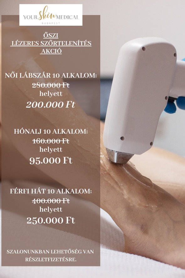őszi-akció-2023